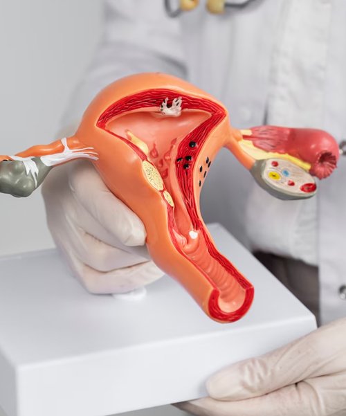 Gynecology and Obstetrics gyane - Gynecology and Obstetrics