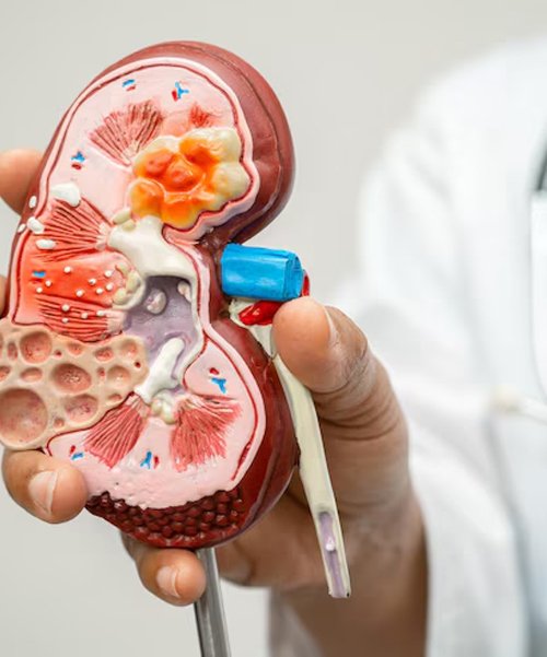 nephrology - Nephrology